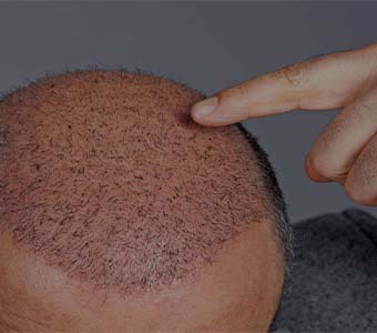 anti aging treatment clinic in near tambaram